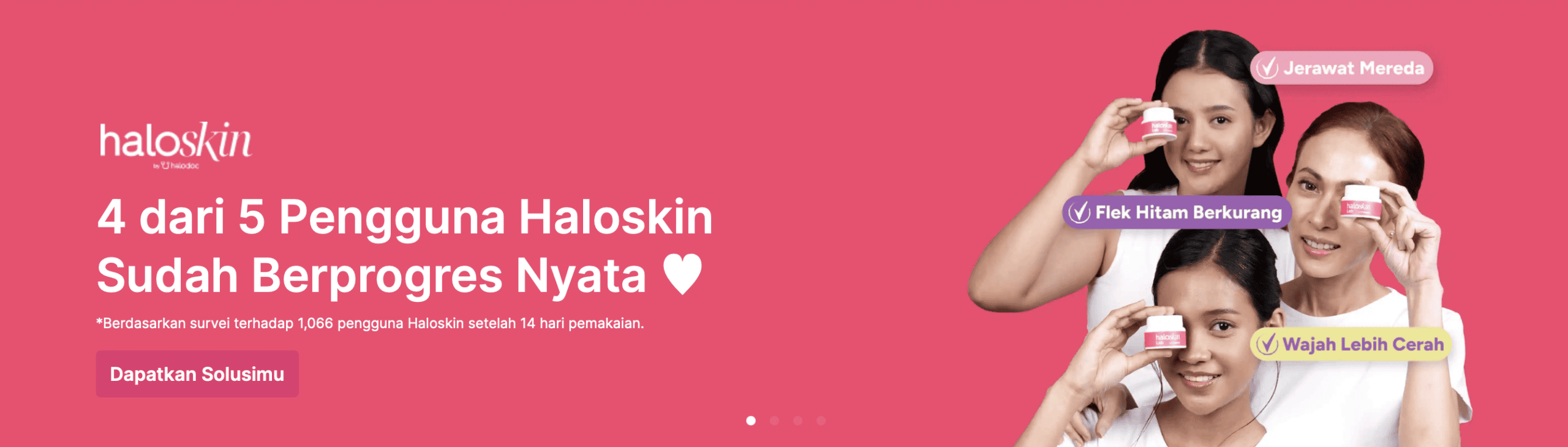 mengatasi jerawat membandel